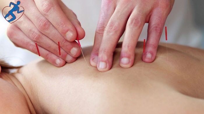 Acupuncture vs. Other Alternative Therapies: What Makes it Unique?